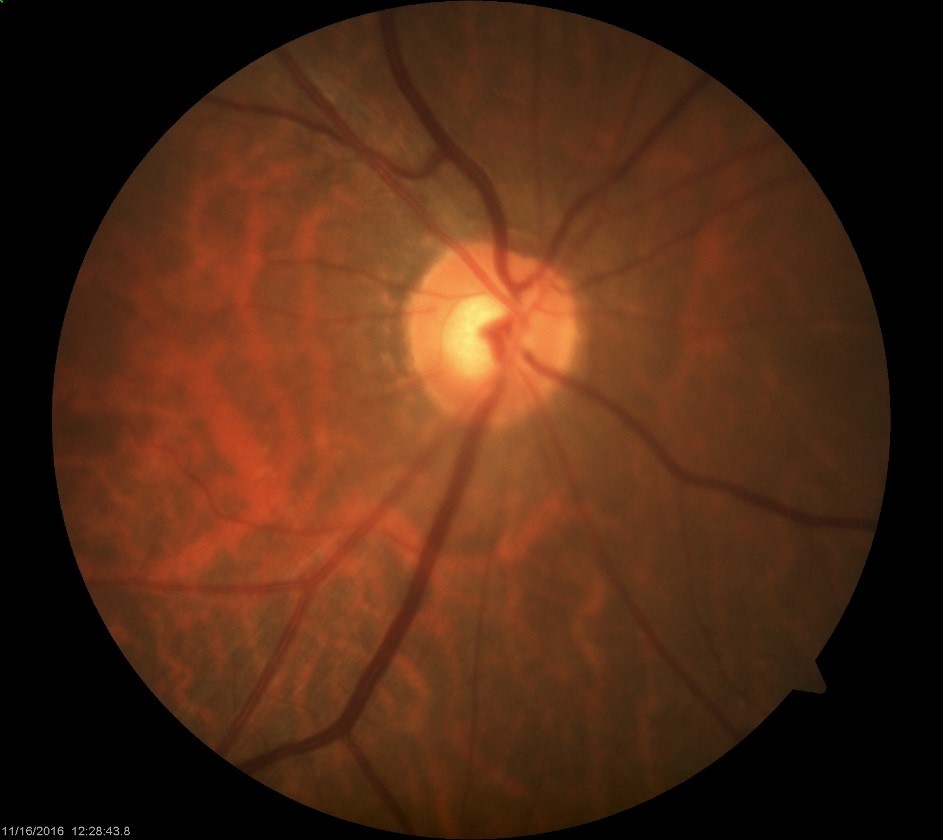 Neuro-Ophthalmology