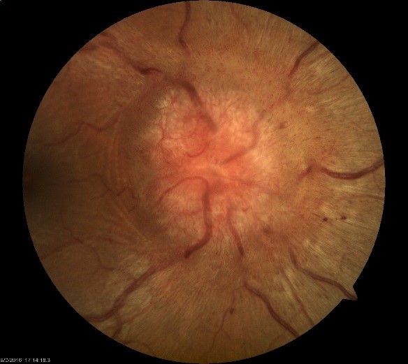 Neuro-Ophthalmology