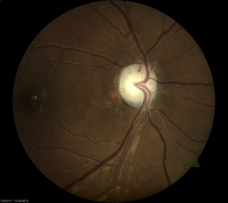 Neuro-Ophthalmology