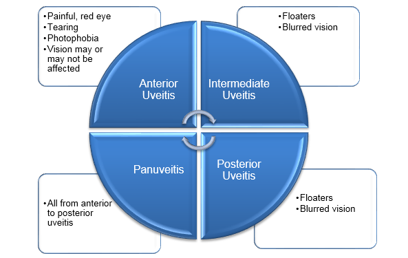 Symptoms of Uveitis