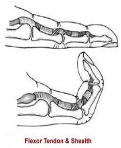 Flexor Tendon & Shealth