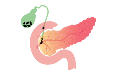 Gallbladder & Bile duct